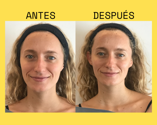 Resultado antes y después