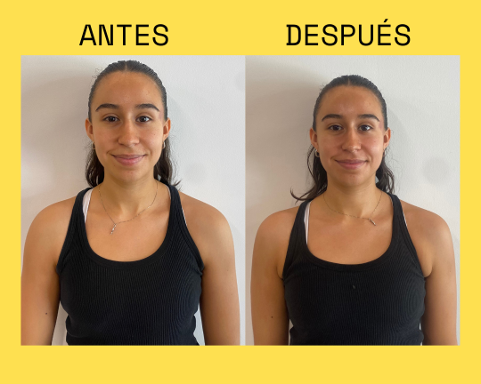 Resultado antes y después