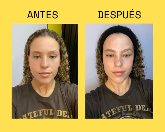 Resultado antes y después