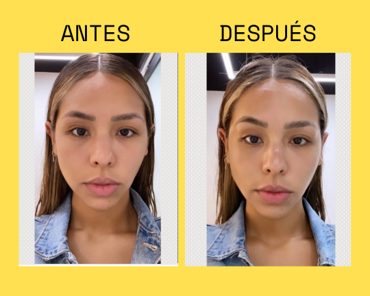 Resultado antes y después