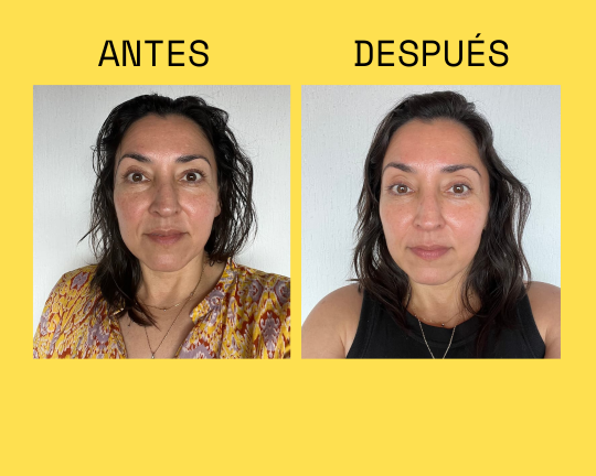 Resultado antes y después